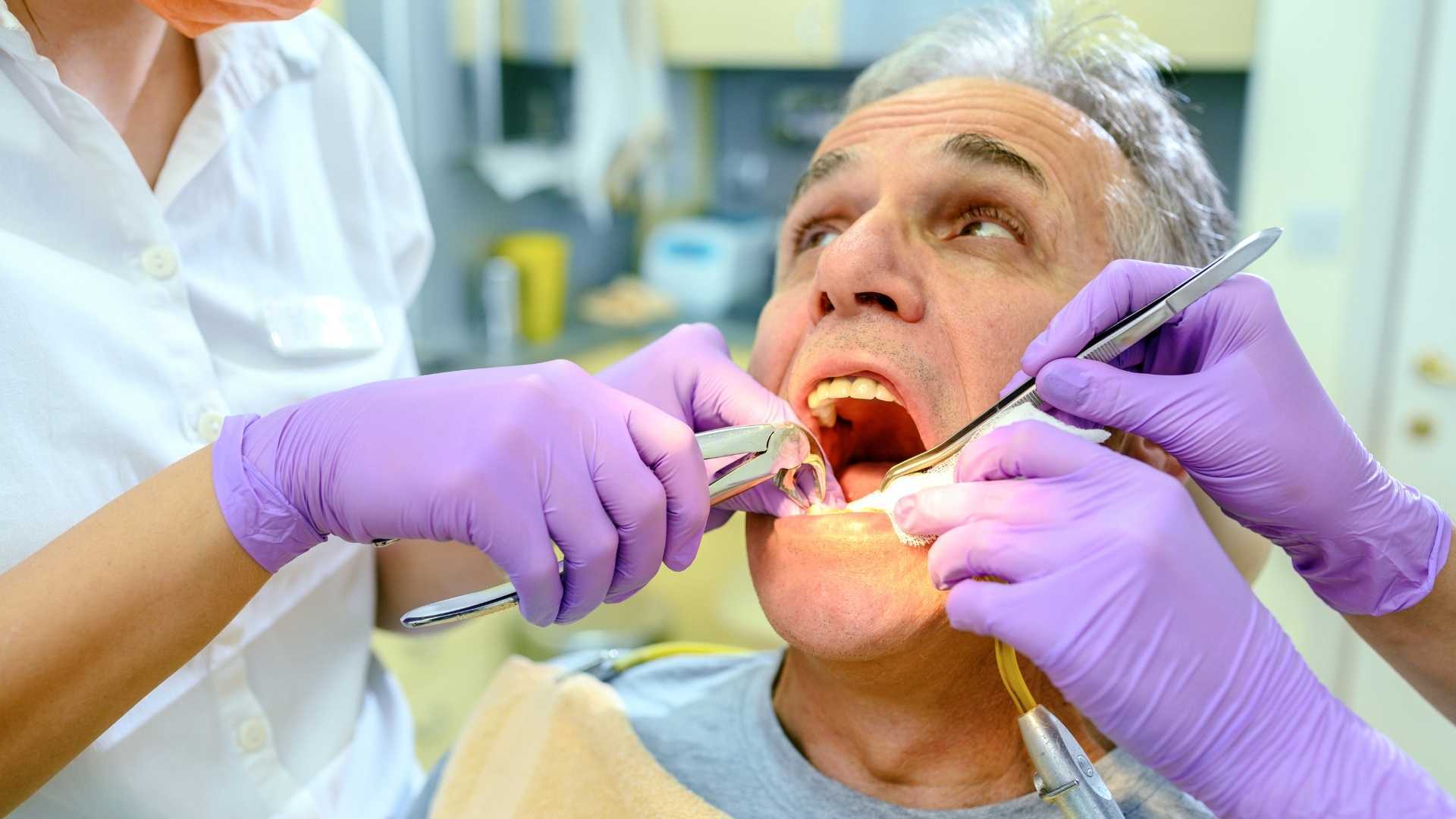 What's the difference between a tooth extraction and a dental root canal?